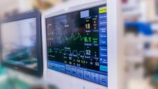 Cardiac monitors in a hospital setting